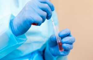 Varianti Covid, come si comportano e quanto dobbiamo preoccuparci Varianti