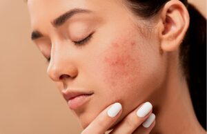 L’importanza di una visita dermatologica dermatologia