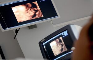 La prevenzione inizia da un’ecografia