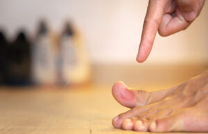 Tutto quello che c’è da sapere sulle vesciche ai piedi vesciche ai piedi