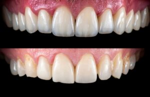 Scopri i vantaggi dei dentisti in Croazia: esperienza di prima classe