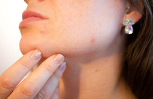 Il dermatologo può salvarti la pelle