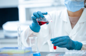 Esami del sangue: il tagliando periodico per una vita in salute