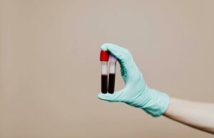 Gli esami del sangue a Bologna: quali sono i principali e cosa possono dirci? esami del sangue san lazzaro di savena