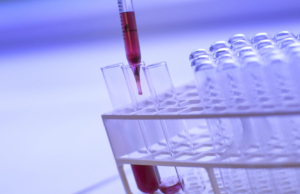 Le cellule del nostro sangue: chi sono, come sono fatte e cosa dicono sulla nostra salute ? esami del sangue