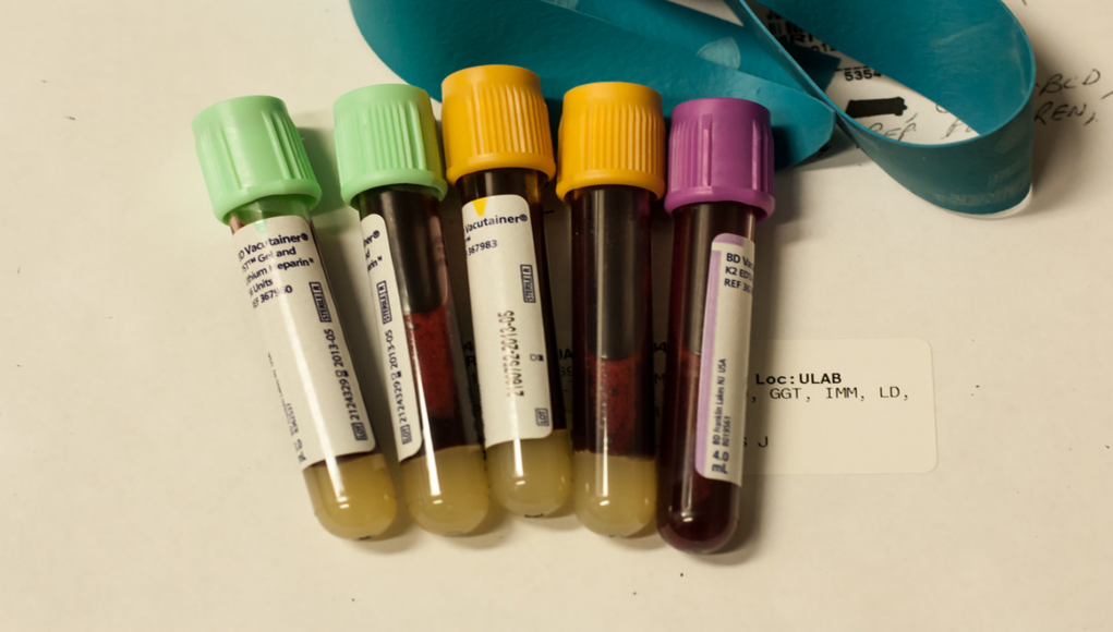 esami del sangue