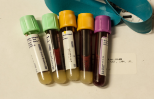 Indici di infiammazione e marcatori tumorali: importanti ma da interpretare con cautela esami del sangue