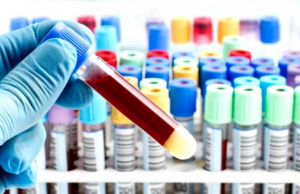 Gli esami del fegato e dei reni, diamo significato ai numeri che troviamo sul referto esami del sangue