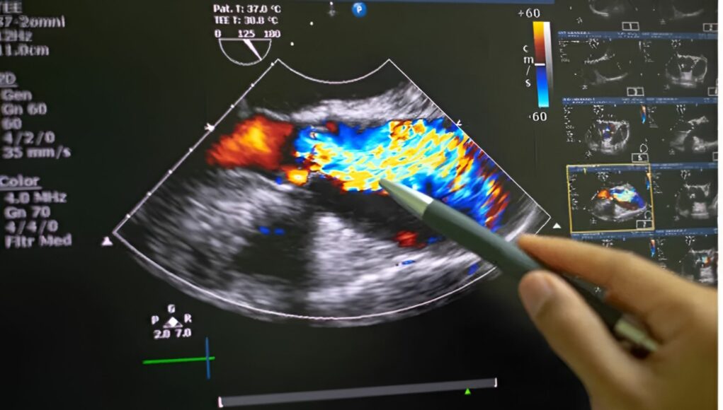 types-of-Echocardiograms