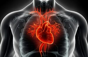 Eco doppler alle carotidi: un avversario della mortalità. ecodoppler carotidi